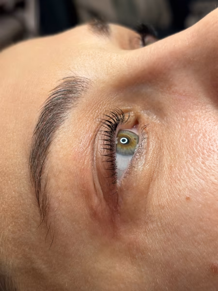 obrve poslije tretmana